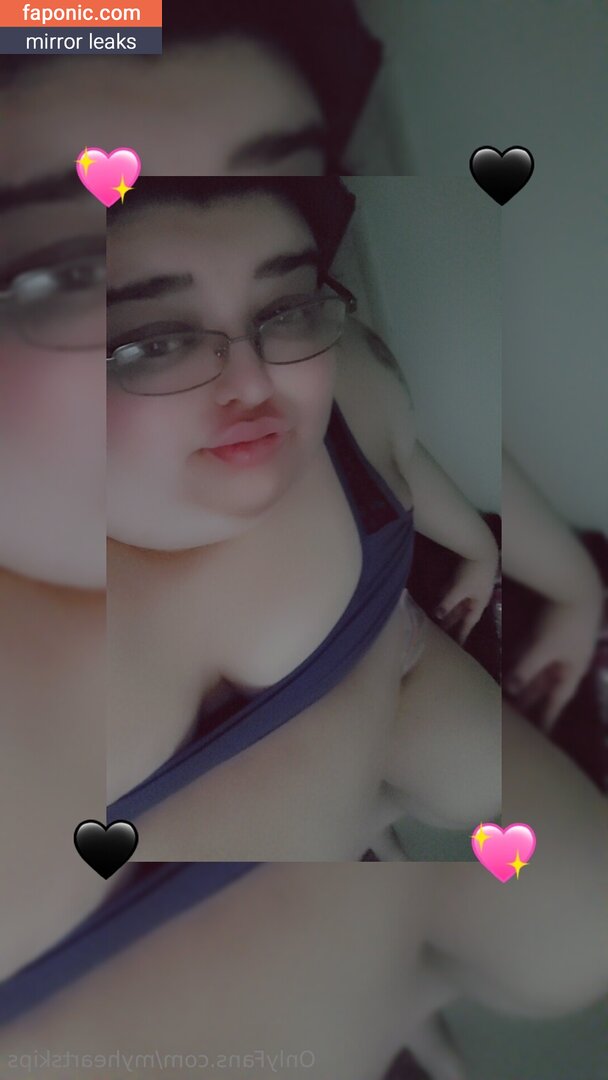 myheartskips